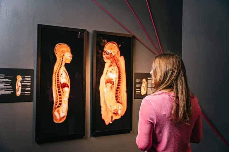 Berlin: Tickets for the BODY WORLDS Museum in Berlin - Audio, phone support, and the friction points to expect